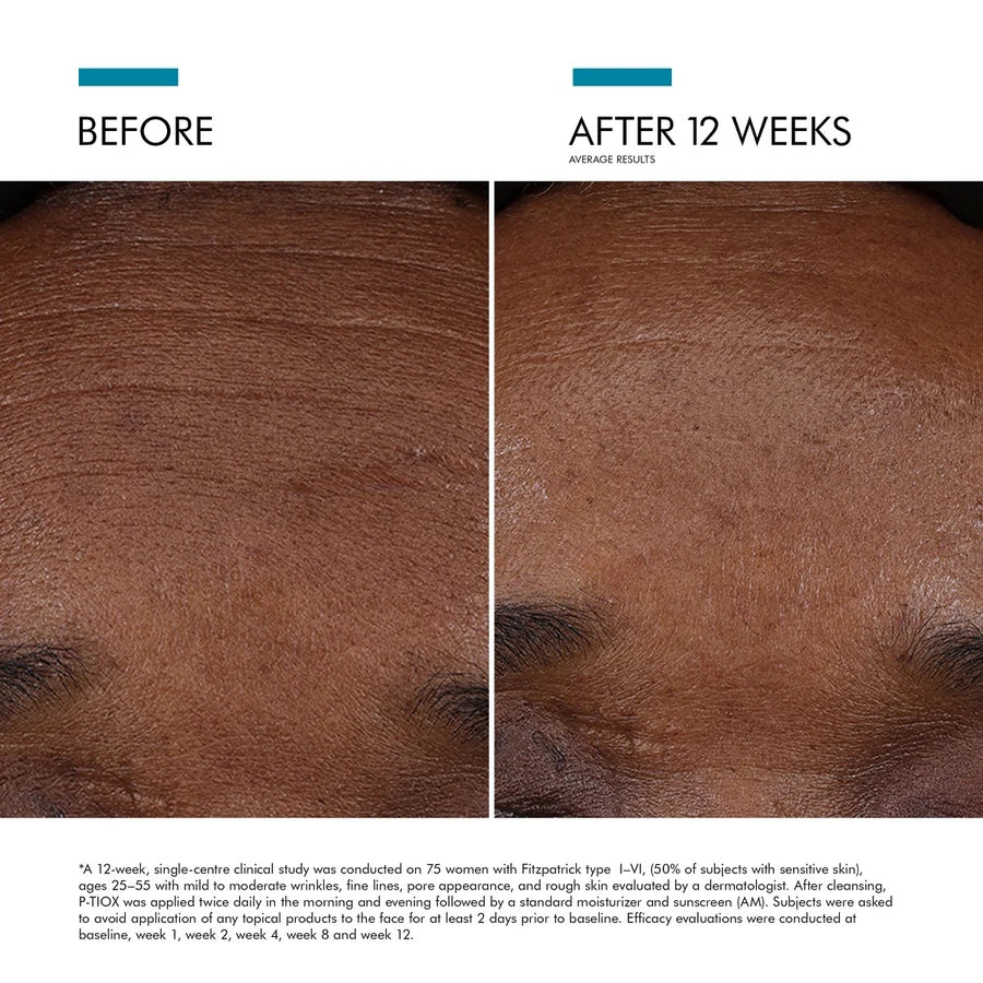 SkinCeuticals kampanje - kjøp P-Tiox serum få C E Ferulic i gave