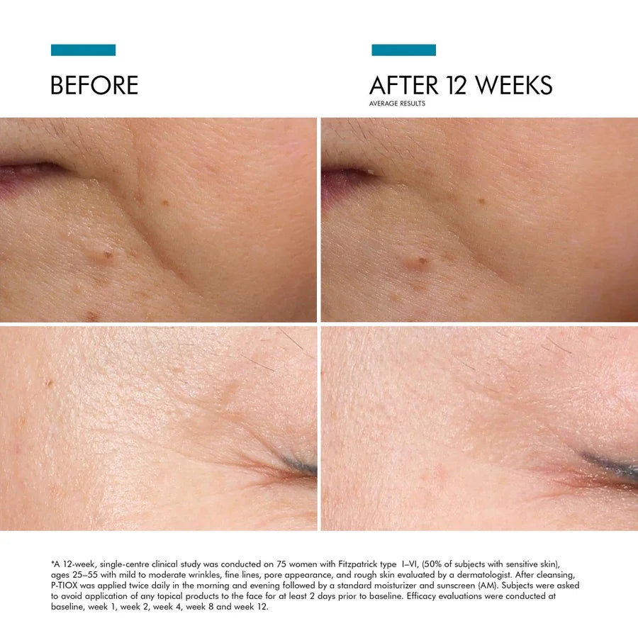 SkinCeuticals kampanje - kjøp P-Tiox serum få C E Ferulic i gave