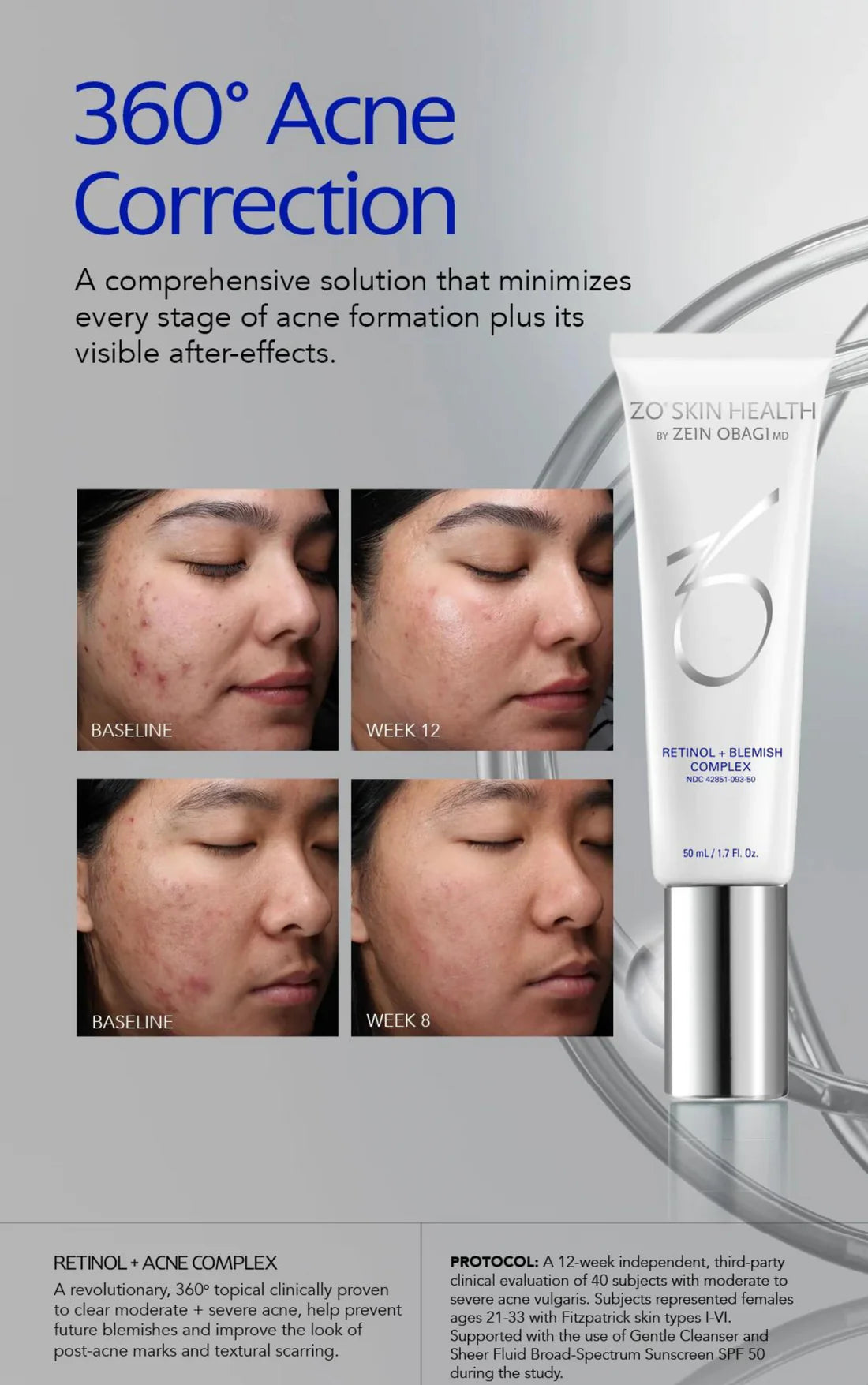 ZO Skin Health Retinol + Blemish Complex 50ml