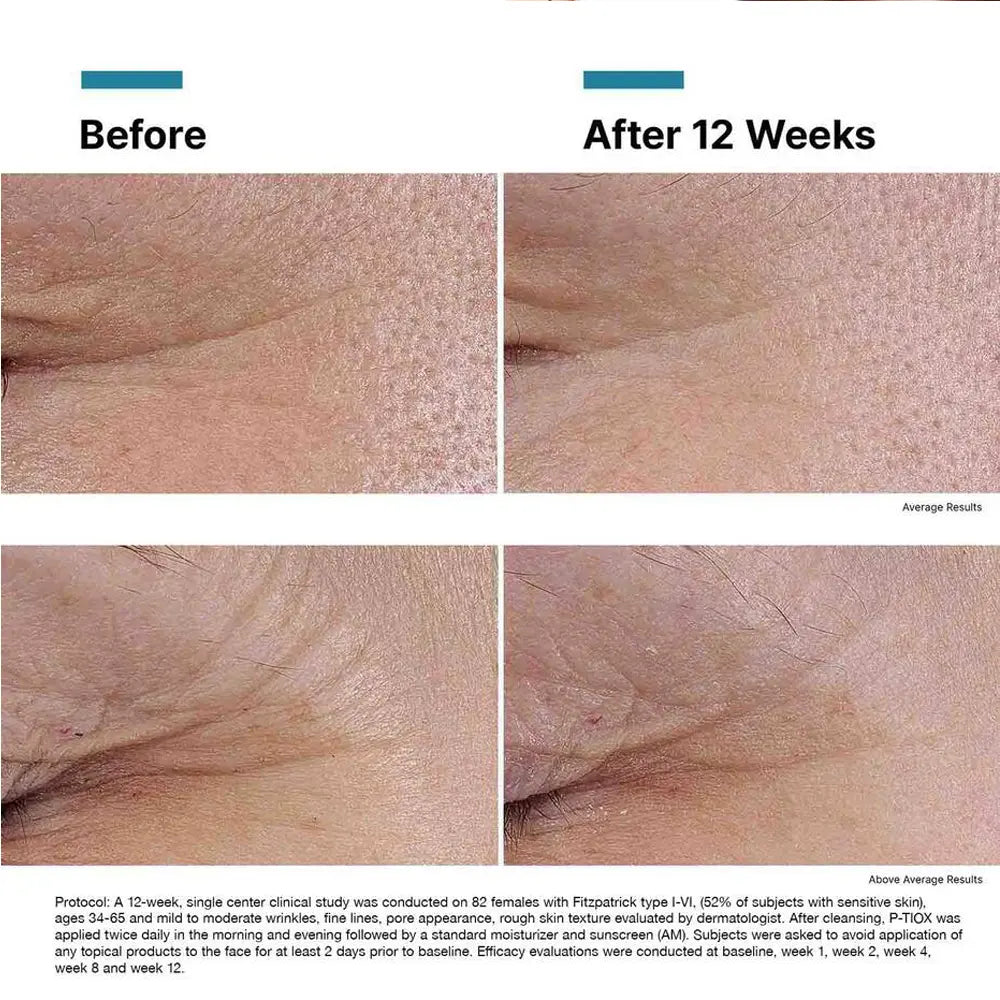 SkinCeuticals kampanje - kjøp P-Tiox serum få C E Ferulic i gave