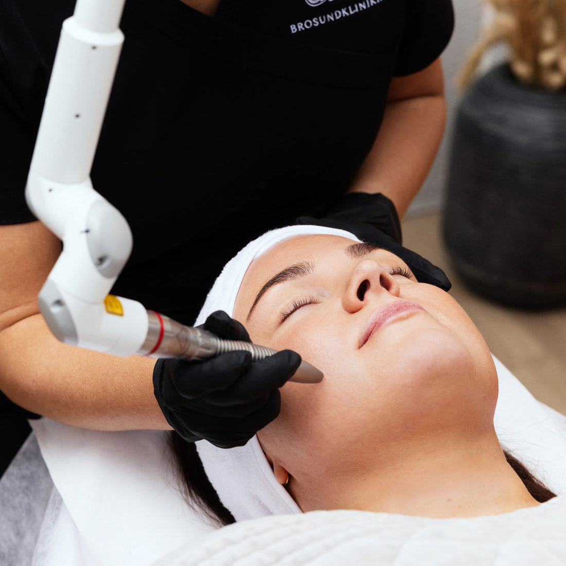 Fotona Laserpeel